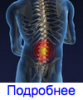 Подробнее о симптомах поясничного остеохондроза