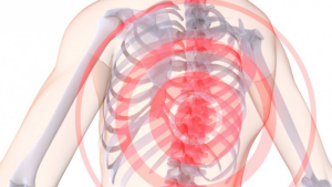 Остеохондроз грудного отдела позвоночника симптомы