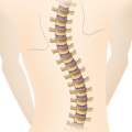 Как влияет грудной остеохондроз на поджелудочную железу thumbnail